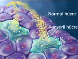 Kanserli hücreyi yok eden şey